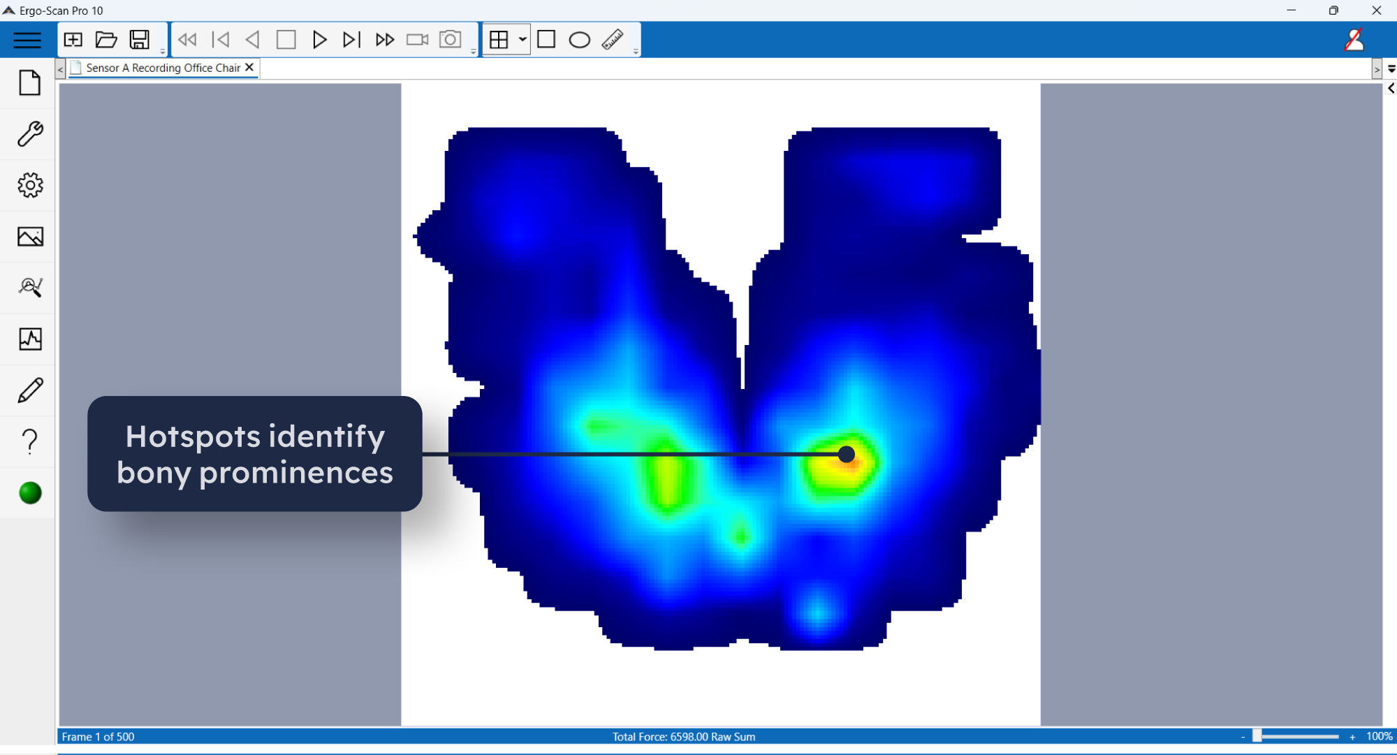 ErGO-Scan software with annotation 