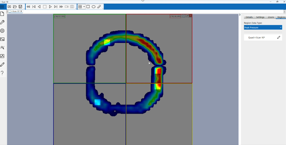 I-Scan 10 Software - multiple panes showing peak pressure