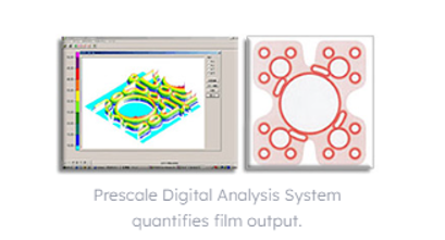 Prescale Digital Analysis System