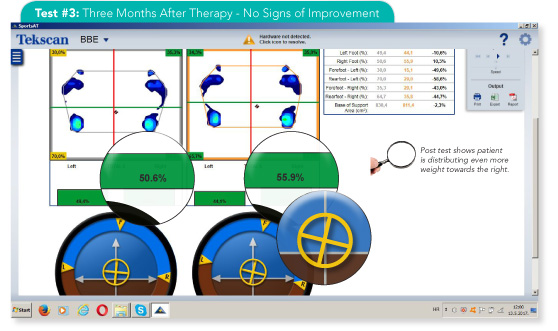 Post-rehab testing showed no signs of improvement, confirming the need for objective methods to monitor progress.