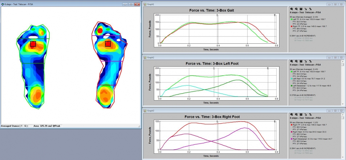 Physiomat including a three-dimensional moveable plate with integrated