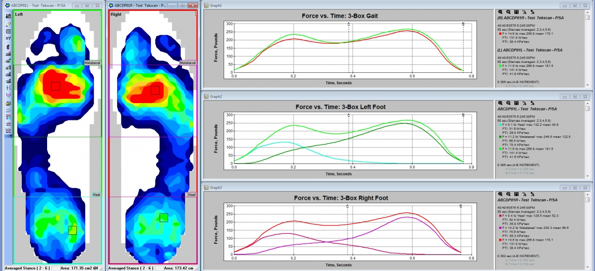 Segment the foot for a detailed analysis of how the foot is functioning inside the shoe.
