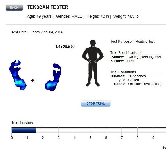 Software automatically calculates a score for the BESS test.