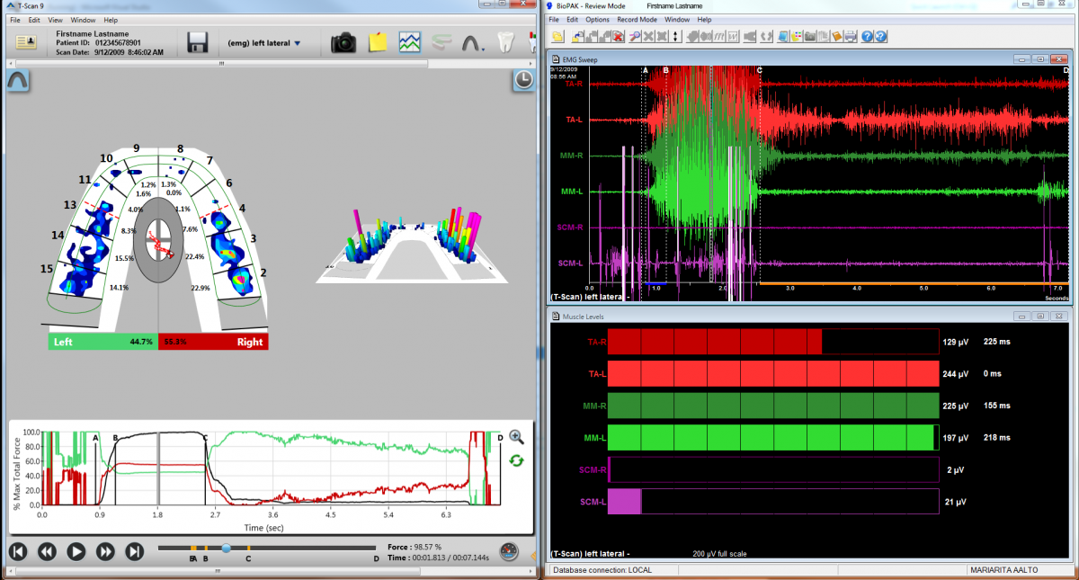 T-Scan 9.1 and EMG