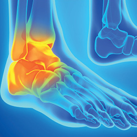 New Technology for Objective Assessment of Chronic Ankle Instability