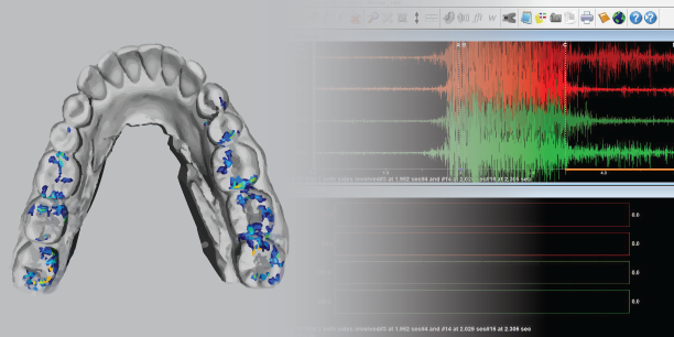 T-Scan v10 sample output