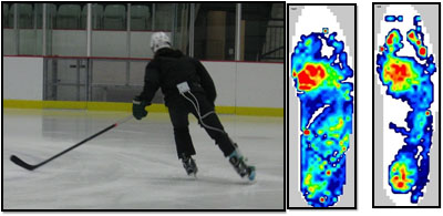  Set-up of wireless in-skate system for force and impulse data collection (left). Examples of pressure mapping inside skate for both NS and OS conditions (right). Image courtesy of Kendall M. et al.