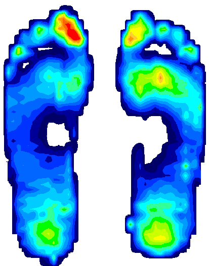 FootVIEW Sofware for F-Scan GO
