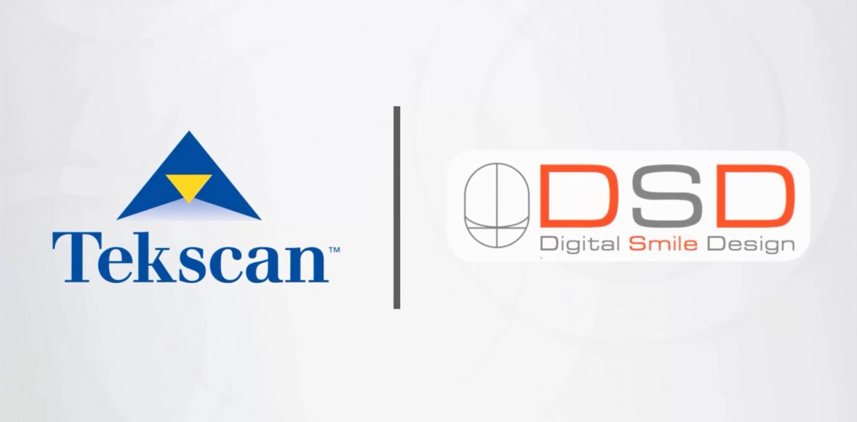 Tekscan and Digital Smile Design