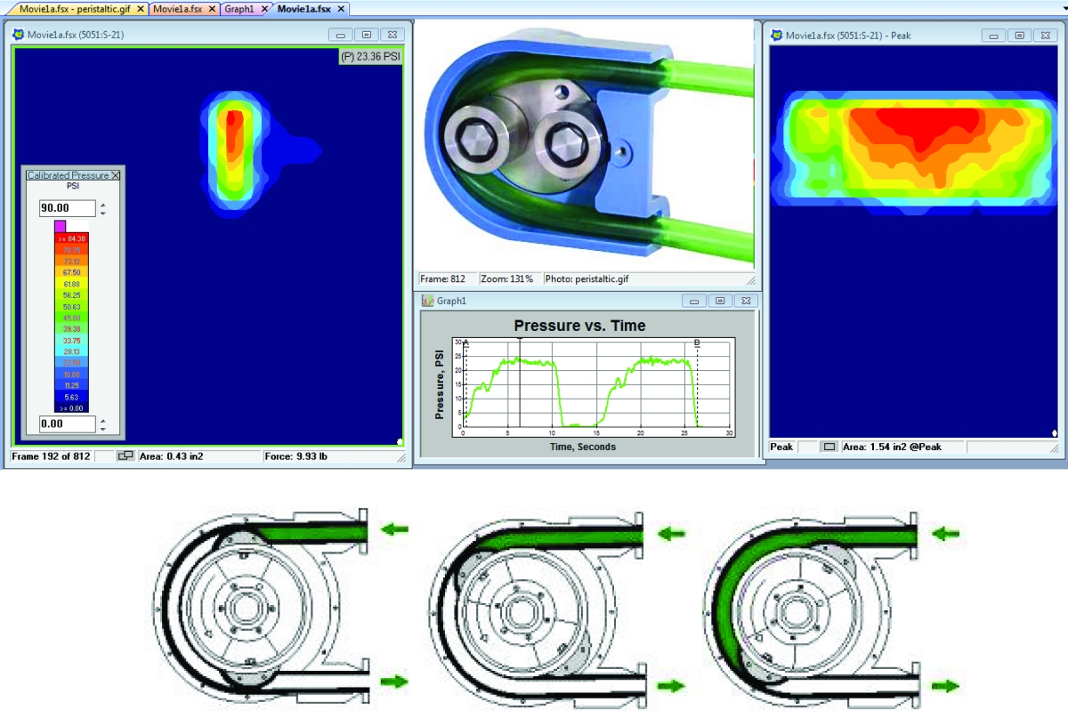 Peristaltic Insulin Pump