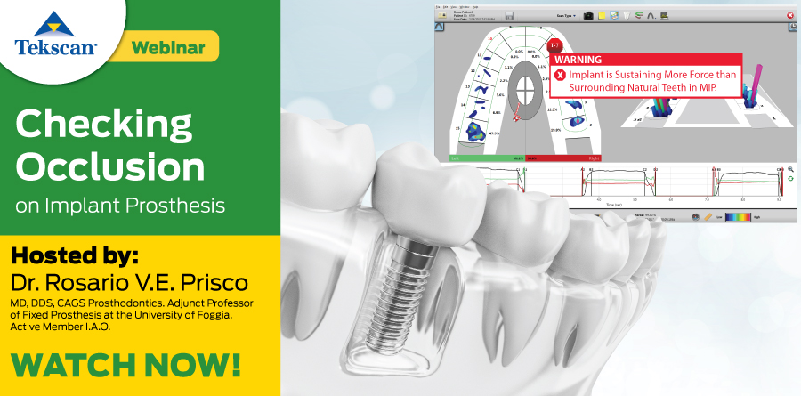 Checking Occlusion of Implant Prosthesis