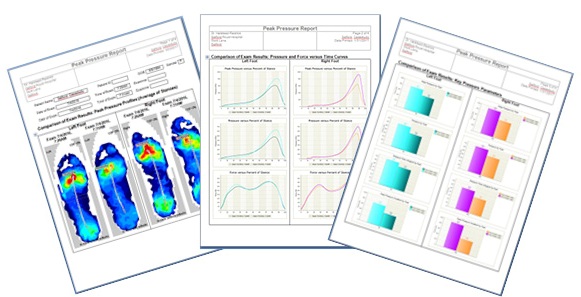 Peak pressure reports are generated at the click of a button and provide a way to document treatment progress.