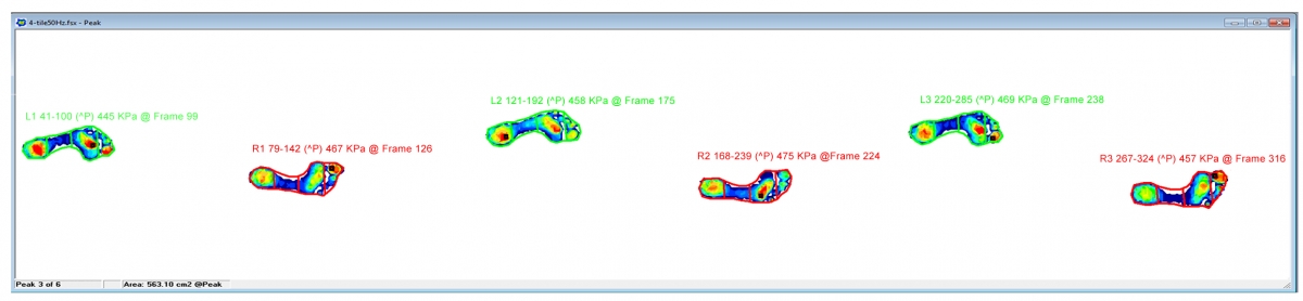 Segment the foot to analyze specific areas of the foot for detailed analysis.