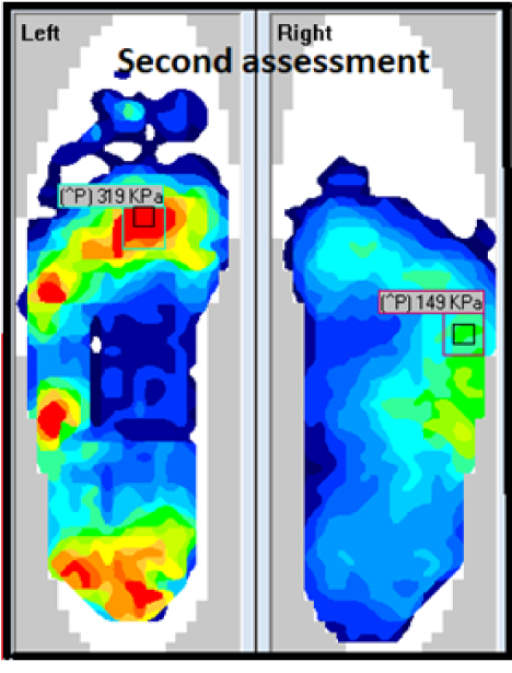 Fig #4: Second F-Scan assessment.