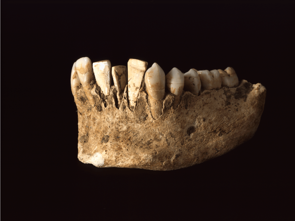 Cosmetic Dentistry- Global Estetik Dental Care