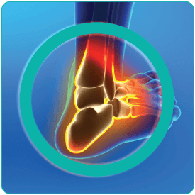 The Effect of Incongruity and Instability on Contact Stress Directional Gradients in Human Cadaveric Ankles