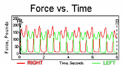 Gait Curve After Temporary Orthotic