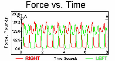 Gait Curve After Heel Lift