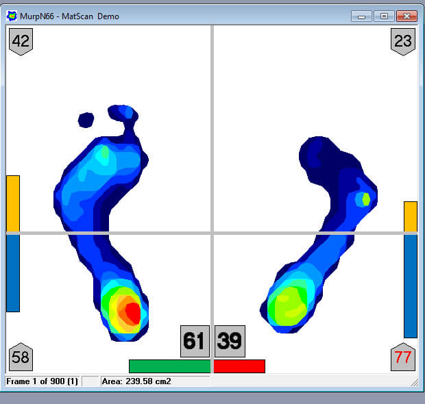 Quickly &amp; easily evaluate stability with instant weight bearing insights.