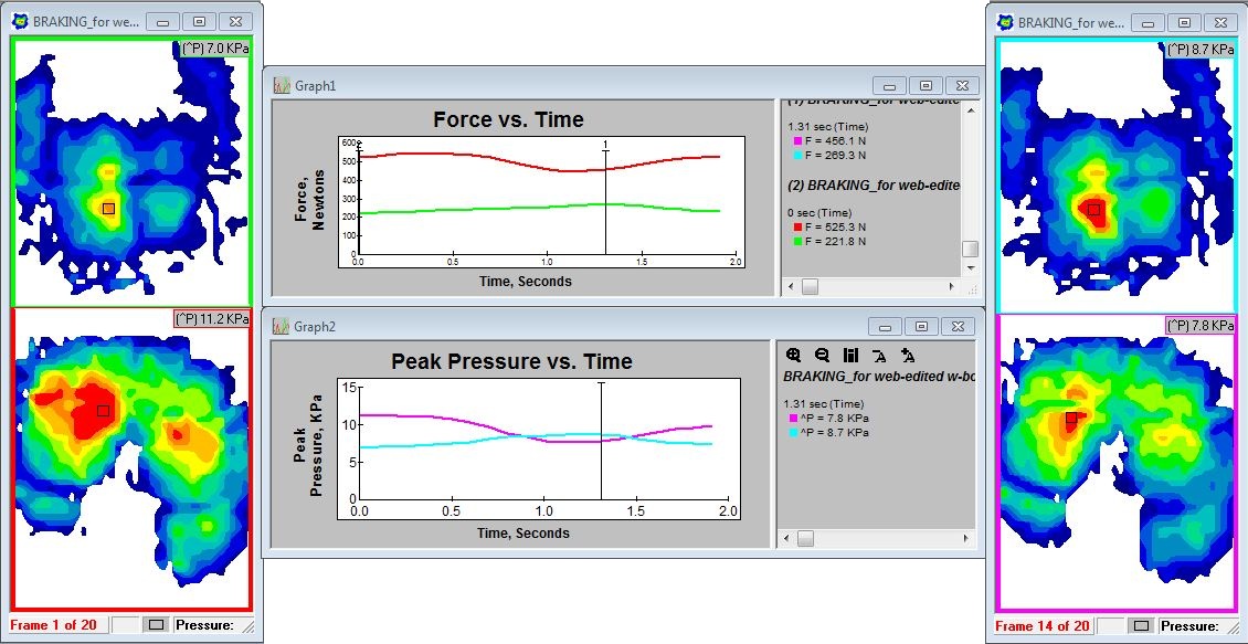 This screenshot represents the pressure distribution of the driver as he prepares to apply the brakes.  The (red) elevated pressure on his right buttock is a result of lifting his right foot.  The colored image on the right shows the change in pressure distribution that occurs while applying the brakes.  Note that the (red) high pressure region shifted from the buttocks to the lumbar region.