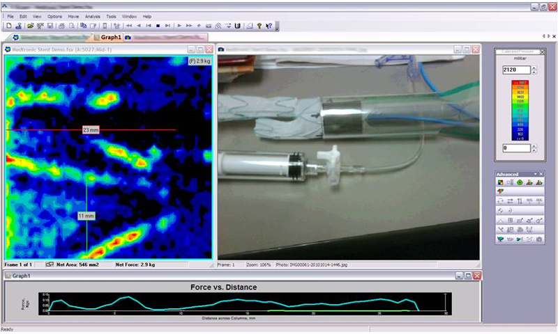 Balloon Catheter (stent material & process R&D)