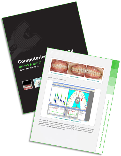 Computerized Occlusion eBook