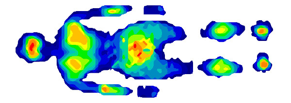 Subject shown lying on a 2-sensor configuration (model #5400N).