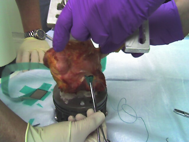 Evaluating joint pressures in a cadaver knee.