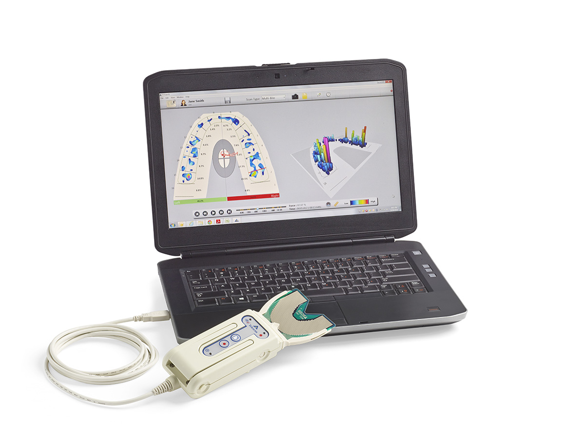 TScan Occlusal Analysis System Tekscan