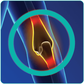 Medial Ulnar Collateral Ligament Injuries of the Elbow: Stretching and Cutting Models