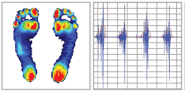 EMG and plantar pressure shown here.