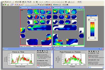 Above: Pressure data collected while subject operates an industrial floor polisher.  Comparisons of Force vs. Time and Peak Pressure vs. Frames are shown for both the Left and Right hands.  Peak pressure areas were detected on the left hand along the palm, while the right hand experience greater pressure in the middle phalanx of the second finger.