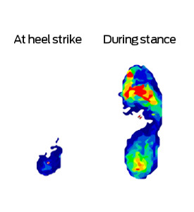 Figure 3a - Plantar pressure profiles: F-Scan images of gait breakdown from heel strike and during stance on the left.