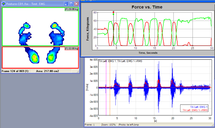 EMG data with plantar pressure and force vs time curves
