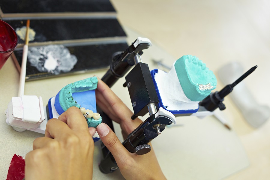 Dental Occlusal Adjustment Tekscan