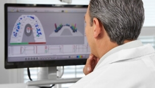 Bite Force Measurement with T-Scan