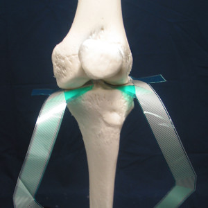 Sensor in knee joint