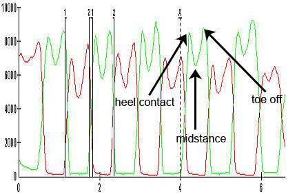 Force vs. Time Graph - After Orthotics