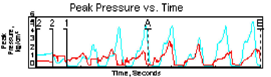 Peak Pressure Versus Time Curve - After Orthotic