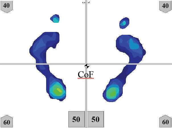 Matscan Pressure Profile Center of Force