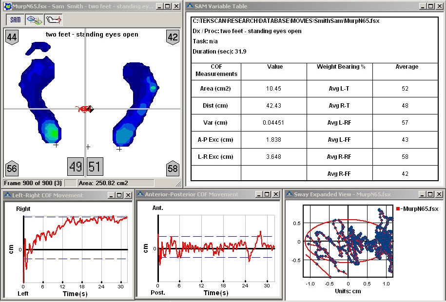 Sway Analysis Module