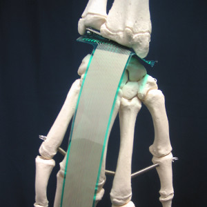 Sensor in wrist joint