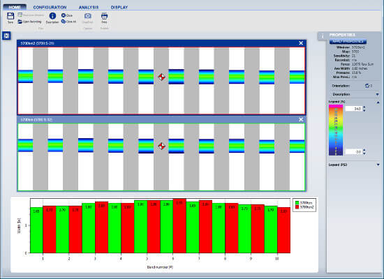 Sample software output from Tekscan's NPAT