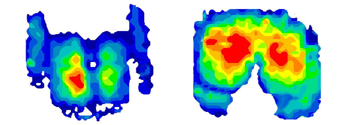 Pressure imaging for automotive seating