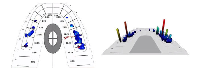 Pressure imaging for dental occlusal analysis