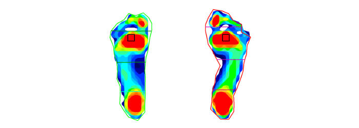Pressure imaging for foot function
