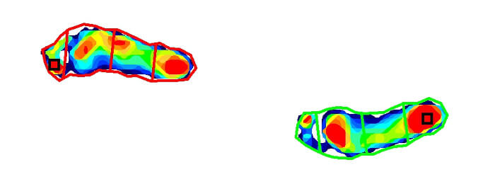 Pressure imaging for gait analysis