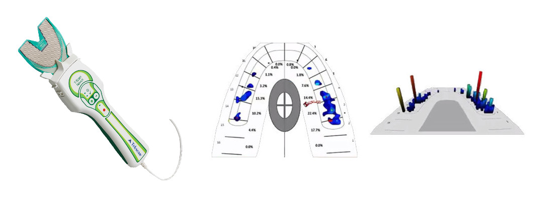 Dental occlusal analysis system