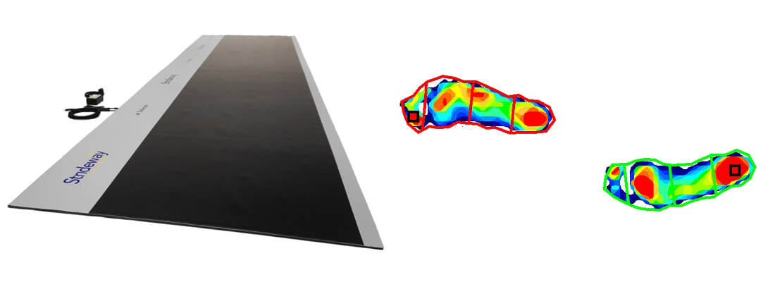 Plantar pressure mapping system