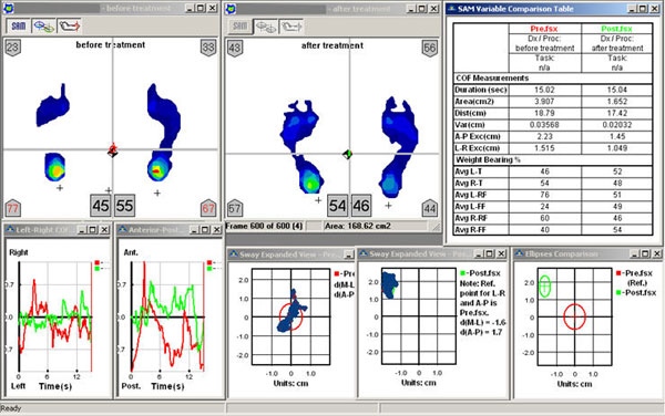 Sway Analysis Software